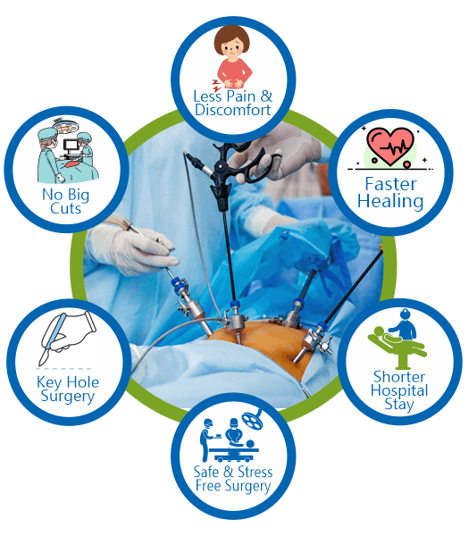 Key Benefits of Laparoscopic / Robotics Surgery
